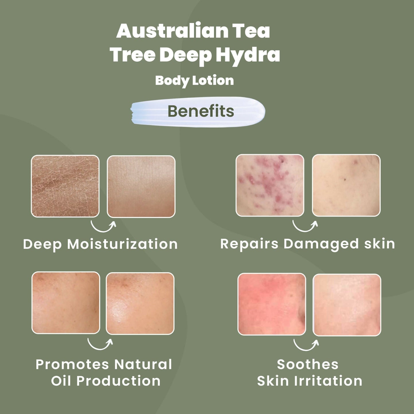 Wild Oak Shea Butter & Australian Tea Tree Body Lotion